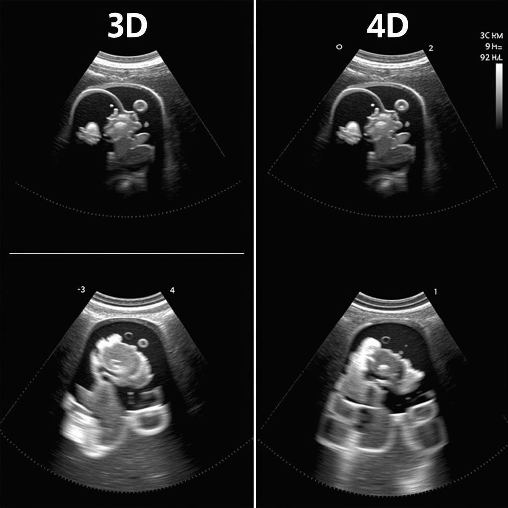 Comparison of 3D and 4D Ultrasound Images